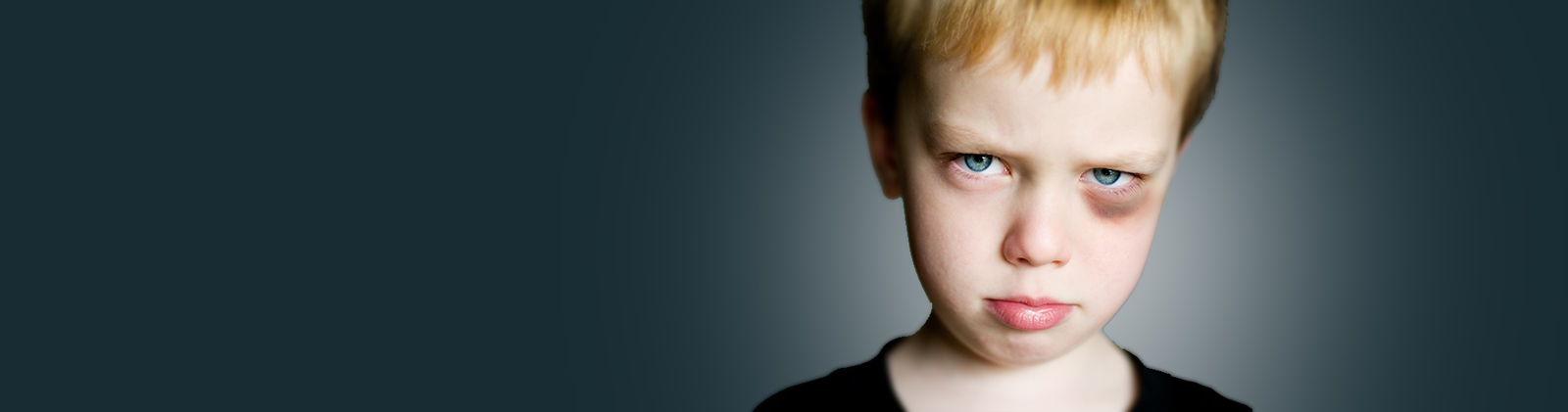 Preventing Eye Injuries in Children