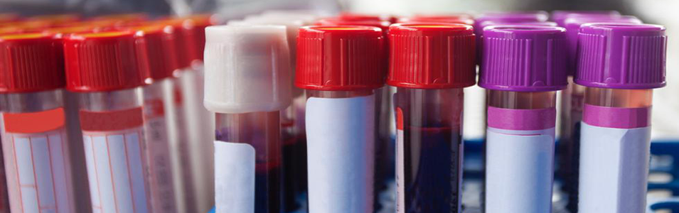 Can a Blood Test Tell You If You Have Cancer? Not Yet – But Maybe Someday