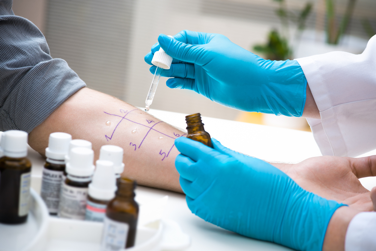 What to Expect When You Go For Allergy Testing